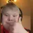 XDTric